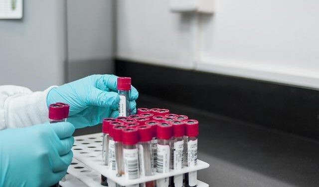India recognises Nepali lab for fresh produce export testing – FreshPlaza
